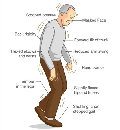 L-DOPA supplement benefits1 L-DOPA supplement benefits1