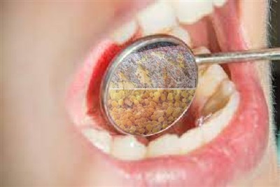 Zrozumienie ustnych plam, złego oddechu i sposobu radzenia sobie z nimi