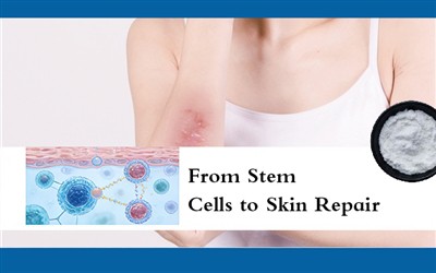 Od komórek macierzystych do naprawy skóry
