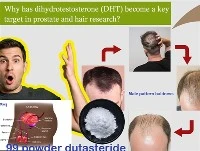 Dlaczego DHT stał się kluczowym celem w badaniach nad prostatą i włosami